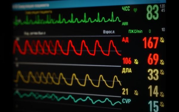 Cardio monitor