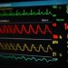 Cardio monitor