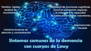 La demencia de los Cuerpos de Lewy
