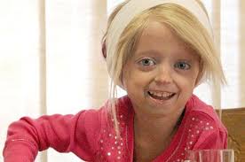 Progeria. Alargar la vida. Lopez Otín