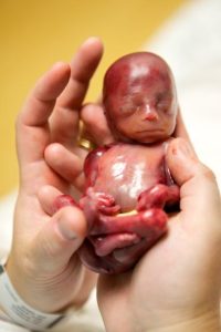 Aborto = Muerte